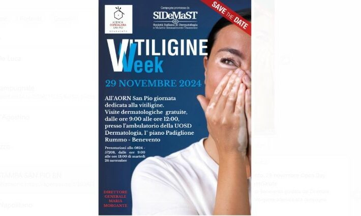 “Vitiligine Week”